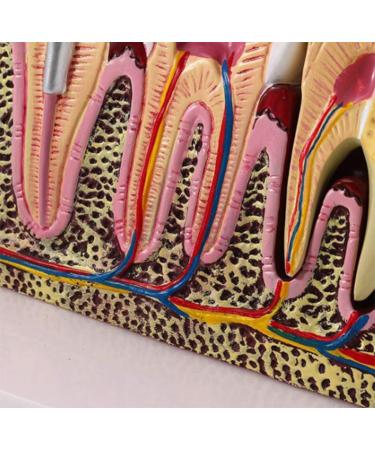 PSVOD 4x4 Anatomy Models for Dental Diseases | Educational Tools for Oral Care & Teaching - Buy Online on GoSupps.com