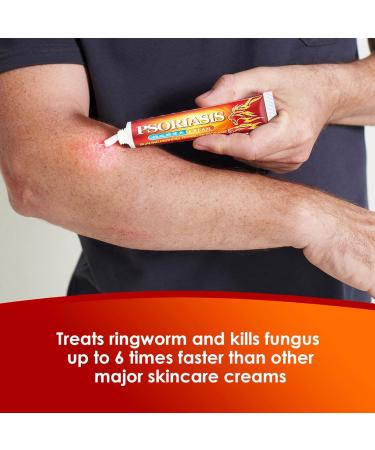 20g Itching Cream | Anti Itch Relief Treatment for Dry Skin Rashes | Men & Women - Buy Online on GoSupps.com
