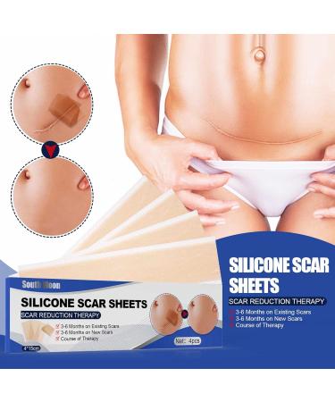 Silicone Scar Sheets for Treatment & Removal - Reusable, Professional Grade - C-Section, Surgery, Acne, Keloid - 1.6x6 (4 Pack) - Buy Online on GoSupps.com