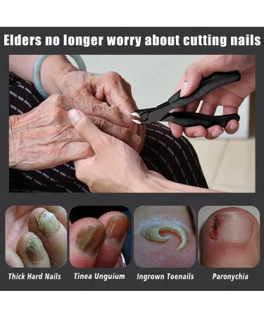 Senior Heavy Duty Toenail Clippers for Thick Toenails - Men and Women, Anti-Slip Handle, Nail File & Pick Included - Buy Online on GoSupps.com