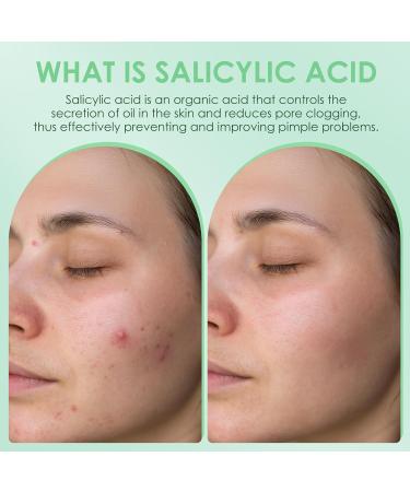 AUSLKA Salicylic Acid Spray Helps Reduce Redness and Breakouts Multi-Purpose Topical Facial Skin Repair Mist with 2% Salicylic Acid Travel Size Salicylic Acid Spray for Face & Body (3.4 Fl Oz) - Buy Online on GoSupps.com