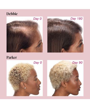 Viviscal Hair Growth Bundle for Women: Supplements for Thicker Hair + Thickening Serum - Buy Online on GoSupps.com