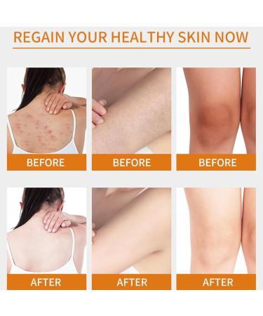 AmourGlint Exfoliating Body Scrub Body Scrub Exfoliator Exfoliator with fruit extract exfoliating makes the skin exceptionally smooth and soft suitable for all skin types coconut 350ml coconut 400 g Pack of 1 - Buy Online on GoSupps.com