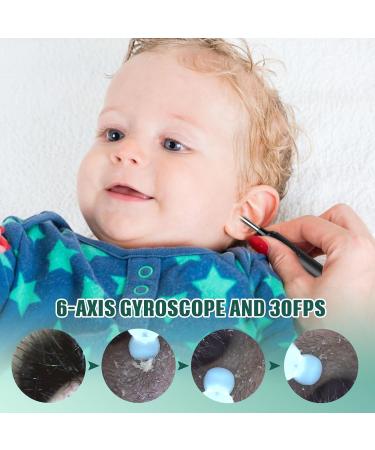 Ear Wax Removal Kit with 1080P Ear Camera - Black | LMECHN Ear Cleaner for iPhone, iPad, Android Phones - Buy Online on GoSupps.com