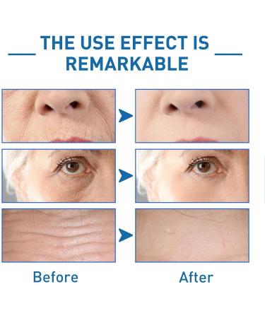 ZCSXK Skin Repair Moisturizing Moisturizing Oligopeptide Face Fragrancefree allnatural brightening essence for all skin types - Buy Online on GoSupps.com