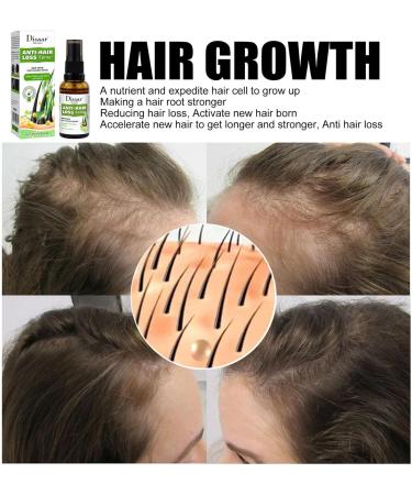 YLYY 30ml Hair Growth Spray Moisturizer | Hair Thickening Products for Women Hair Loss Treatments for Women and Men For Longer Thicker Fuller Hair B:30ml - Buy Online on GoSupps.com