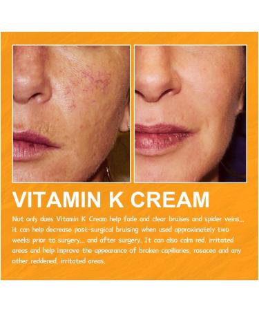 EXQST Fivfivgo Varicose Veins Miracle Cream Varicose Veins Treatment Cream Improves Circulation - Buy Online on GoSupps.com