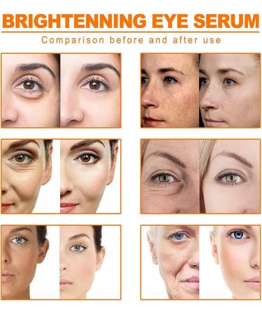 Lavskin Turmeric Serum Turmeric Dark Spot Corrector Serum - Fast Acting Serum Turmeric Repair Face Serum All Natural Lavskin Turmeric Oil for Dark Spots for Face and Skin Lightening (2 Pack) 30 ml (Pack of 1) - Buy Online on GoSupps.com