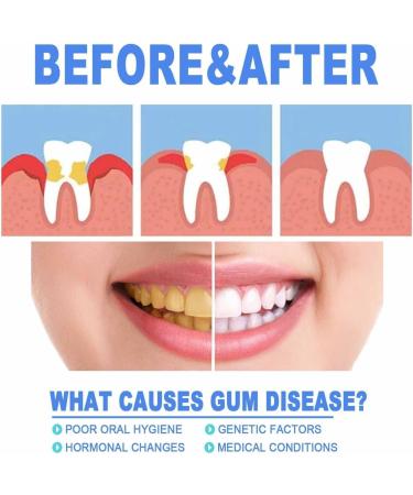 Gum Shield Therapy Gel & Whitening Essence Pen - 3PCS for Enhanced Gum Health & Repair - Buy Online on GoSupps.com