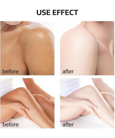 Huile Eclaircissante peau Noire Peeling Visage Puissant Huile Gommage Peeling Corps Huiles Peeling Pour Le Corps Huiles De Peelings Jaune pied Hydratante limine Mortes Peau (1PC 30ML) 1PC 30 ml (Lot de 1) - Buy Online on GoSupps.com