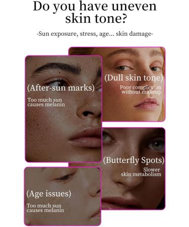  Generisch Arbutin 7% + Tranexamic Acid 4% Cream 70 000 ppm Arbutin 40 000 ppm TXA Niacinamide improves your genetic structure - Buy Online on GoSupps.com