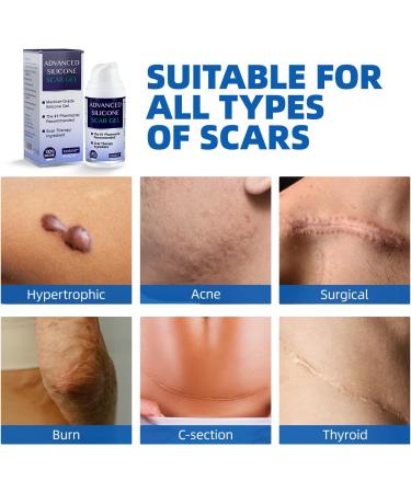 Scar Cream Gel for Face & Body - Effective Treatment for Surgical Scars, Stretch Marks, Acne, Keloids & Burns - 1.05 oz - Buy Online on GoSupps.com