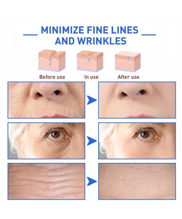 2023 Newest Botox Anti-Aging Collagen Serum for Men and Women - 2pcs 30ml Set - Buy Online on GoSupps.com
