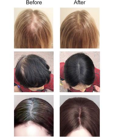 Luxiremi Hair Topper for Women Thinning Hair Synthetic Clip in Hair Extensions Natural Looking Toupee Hairpiece Without Bangs Short Straight Hair Topper Schokobraun Chocolate Brown - Buy Online on GoSupps.com