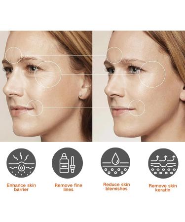 IZBEAUVO Dark Spot Remover for Face Dark Spot Cream Freckle Removal Cream Dark Spot Correcting Glow Serum Dark Spot Corrector Cream Dark Spot Remover Sunspots & Melasma Cream Anti-Aging - Buy Online on GoSupps.com