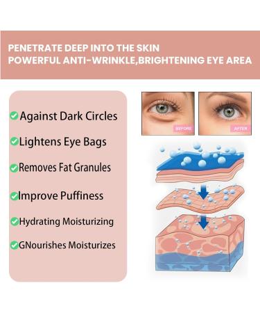 Retinol Eye Cream Anti Wrinkle Eye Cream Eye Cream for Dark Circles and Puffy Eyes Eye Cream Anti Aging with Retinol Coconut Oil and Sodium Hyaluronate Eye Cream for All Skin Types(Retinol) - Buy Online on GoSupps.com