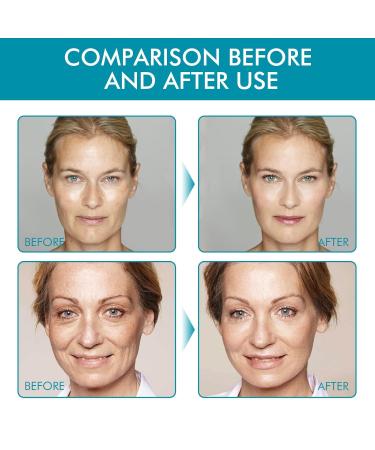 Buy Retinol Cream for Face - Anti-Aging Moisturizer with Collagen & Hyaluronic Acid | Lift Hydrate & Diminish Wrinkles - Day & Night Cream - Buy Online on GoSupps.com