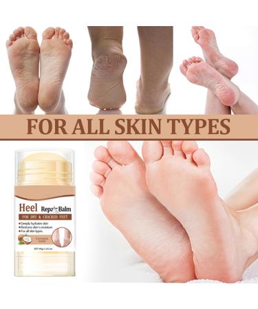  MEITREND Foot care cream for very dry feet and cracked heels foot care cream with coconut oil moisturizing and anti-cracking cream to deeply hydrate feet and hands. - Buy Online on GoSupps.com