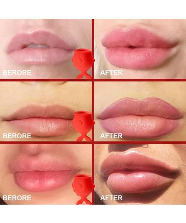 Fish Shaped Lip Plumpers Lip Sucking Devices Long Lasting Plumping Enhancer Innovative Cosmetic Tool Lip care accessory for makeup lovers daily beauty routine and personal - Buy Online on GoSupps.com