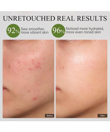 SHVYOG Snail Mucin Mask - Hydrating Snail Rescue Jelly Face Mask with 96% Snail Mucin & Mint Extract for Blemishes & Dull Skin - Buy Online on GoSupps.com