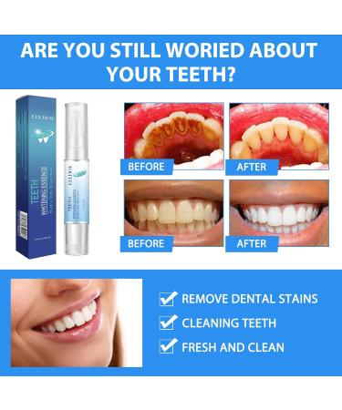 Gum Therapy Gel 2 pcs Tooth Whitening Pens Gum Treatment Gel Teeth Whitening Pen - Buy Online on GoSupps.com