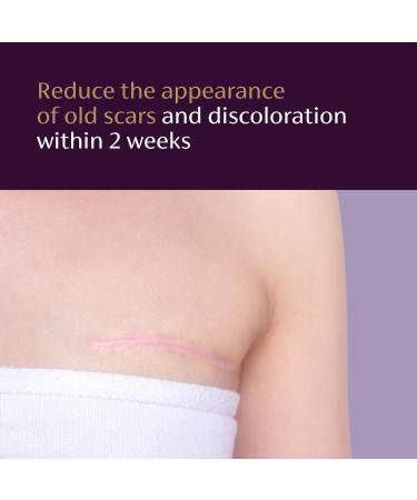 Mederma Scar Serum Triple-Action Formula with Vitamin E Hyaluronic Acid & Niacinamide Clinically Shown to Reduce Old Scars 1 Fl. Oz. - Buy Online on GoSupps.com