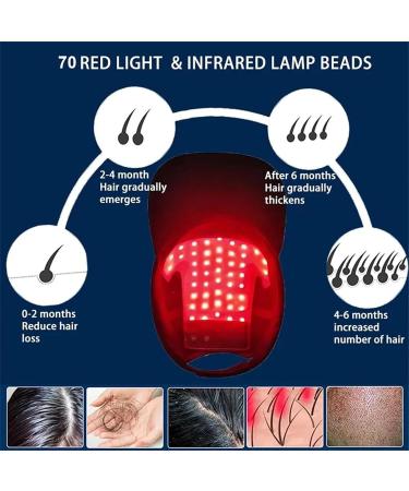 Bonnet De Croissance Des Cheveux - 70 Led Bonnet De Croissance Des Cheveux Double Longueur D'Onde Lumi Re Rouge Et Bleue 4 Modes Massage Du Cuir Chevelu Par Vibration Contr Le De L'Huile - Buy Online on GoSupps.com