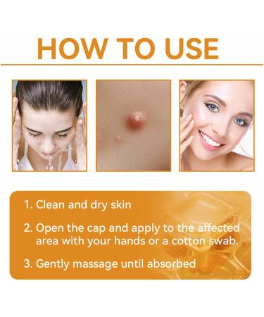 ZVLZVL Bee Venom Treatment Cream - Moisturizer & Skin Repair for Men & Women (30ml) | Buy Internationally - Buy Online on GoSupps.com