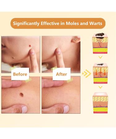 Buy Bee Venom Cream - Hydrating Moisturizing Cream for All Skin Types | 2024 Professional Formula - Buy Online on GoSupps.com