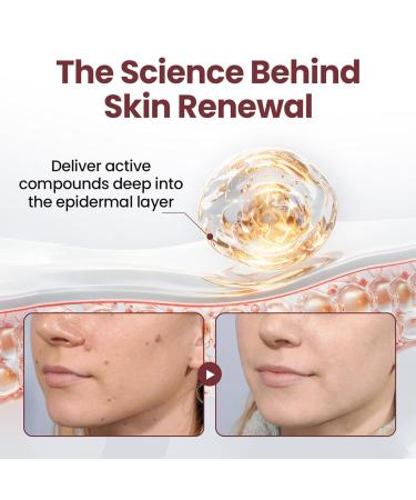 TLOPA KeraErase Dual-Action Renewal Cream Professional Black and White Rice Soothing Repair Cream Face Moisturizer - Improves Moisture Skin Barrier for All Skin Types (1) - Buy Online on GoSupps.com