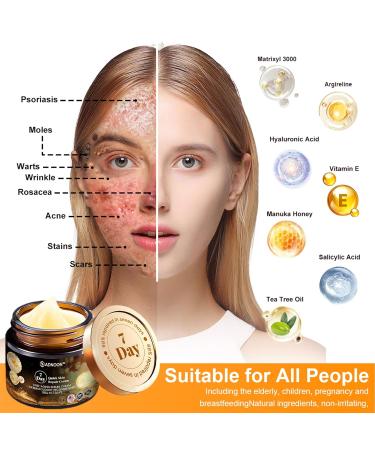 AEEHFENG ADNOON 7-Day Multi-Effect All-in-One Skincare Cream ADNOON Skin Care Cream Professional Bee Venom Cream Fine Line Skin Care Cream for All Skin Types (1 Bottle) - Buy Online on GoSupps.com