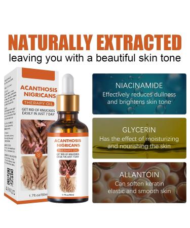Acanthosis Nigricans Therapy Oil - Dark Spot Corrector Serum - 50ml (2pcs) - Buy Online on GoSupps.com