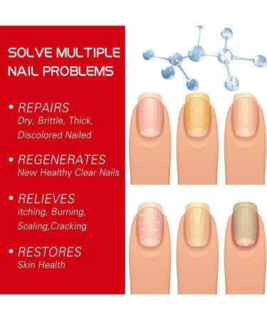 Cuticle and Nail Oil Nail Repair for Growth - Gentle Nail Cuticle Oil Nail Hardener Nail Growth Polish for Adults Teksome - Buy Online on GoSupps.com