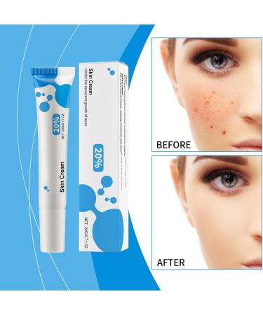 Brightening Cream for Face 20g Pimple Moisturizing Cream Moisturizing Rejuvenating Soothing Cream For Women Daily Use Night Day And Home - Buy Online on GoSupps.com