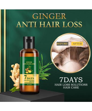 Ginger Huile de croissance des cheveux Ginger anti-chute 7 jours repousse 7 jours huile germ e au gingembre pour nourrir les racines des cheveux r pare les cheveux ab m s nourrit les racines des - Buy Online on GoSupps.com