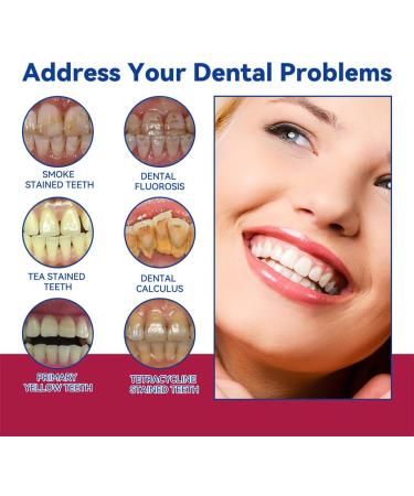 Oraliz Anti-Caries Whitening Toothpaste Anti-Caries Toothpaste Anti-Caries Whitening Active Gingival Restoration Refreshing And Anti-Caries Toothpaste (5pcs) - Buy Online on GoSupps.com