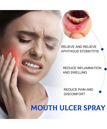 Spray de Soulagement Ulc res Spray Ulc res de la Bouche Spray De Soins Bucco-Dentaires Sprays de Soulagement des Maux de Dents Spray Contre les Aphtes Spray de Soulagement Ulc res Buccaux - Buy Online on GoSupps.com