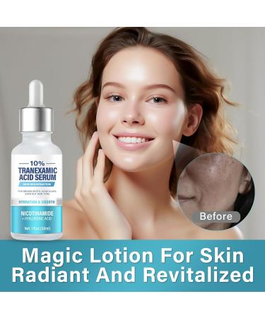 Tranexamic Acid Serum Face Serum - 30ml Soothing Anti-Allergic Anti-Darkness Normal To Dry Skin - for Men & Women - Buy Online on GoSupps.com