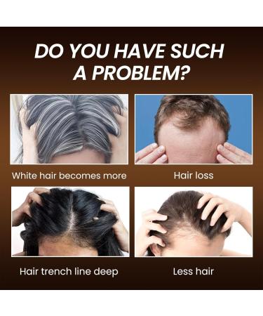  Miake Multiflorum-enriched anti-grey hair serum to naturally reverse grey regrowth for thicker healthier-looking hair 30 ml - Buy Online on GoSupps.com