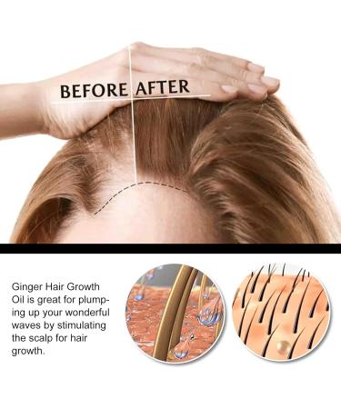 2PCS Suna Plant Extract Hair Growth Oil S rum De Croissance des Cheveux Huile De Repousse des Cheveux Au Gingembre S rum anti-chute de cheveux Hair Growth Serum S rum booster de croissance des cheveux - Buy Online on GoSupps.com