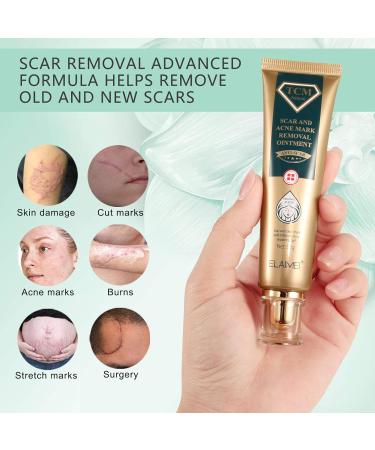RTBYUE Scar Removal Cream - 2 Pack TCM Cream for Surgical Scars, Acne & Stretch Marks - Buy Online on GoSupps.com