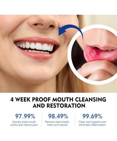Oral Ulcer Sprays Mouth Ulcer Treatment Spray Ulcer Breath Sprays Mouth Ulcer Spray Canker Relief Spray Ulcer Treatment Tongue Herbal Mouth Spray Breath Freshener Spray Effective Canker Sore Treatment - Buy Online on GoSupps.com