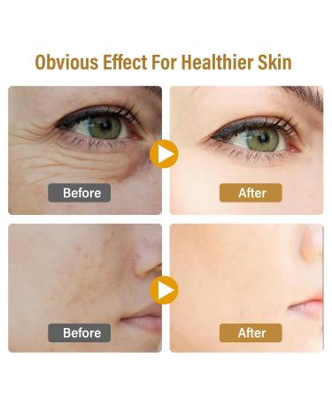 Bee Venom Skin Treatment Cream Natural Face Lifting and Firming Reduces Skin Blemishes Gentle and Non-Irritating for All Skin Types 60ml 2 Ounce (Pack of 1) - Buy Online on GoSupps.com