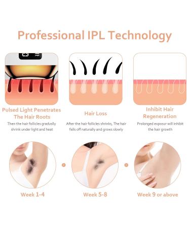 IPL Hair Removal Device for Women and Men - Painless Laser Hair Remover with 99,999 Flashes for Face, Legs, Arms, Armpits & Body - Buy Online on GoSupps.com