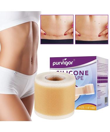 Silicone Scar Tape Roll 1.6 x 60 - Medical Tape for Surgical Scars, Keloid, C-Section, Burns, Injuries - Stretch Marks Removal & Wound Care Bandages - Buy Online on GoSupps.com
