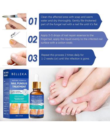 Fungus Nail Treatment - Extra Strength Toenail & Fingernail Repair Solution - Buy Online on GoSupps.com
