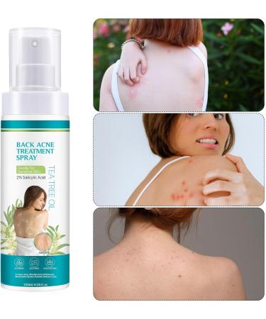 Skin Mist Soothes Irritation 120ml Liquid Against Blemishes Body Acne Spray Improves Skin Clarity For Women Men Youth Shoulder Arm Leg Ma - Buy Online on GoSupps.com