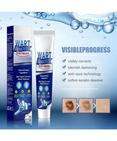 Maximum Strength Wart Removal Cream with Salicylic Acid - Fast-Acting Gel for Genital Plantar Common & Flat Warts - 1PC - Buy Online on GoSupps.com