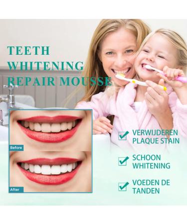 Probiotics Bright Whitening Teeth Mousse - Oral Repair Treatment & Gum Repair Foam (2PC) | Best Teeth Whitening Solution - Buy Online on GoSupps.com