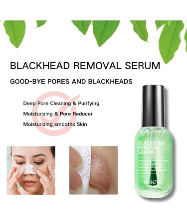 Tongyend Blackhead Removal Serum Nose Blackhead Remover Nose Strips Blackhead Pore Remover Cream Deep Cleansing Pore Strips&White Head Remover for Face Oil-Free Blackhead Remova Nose Strips 17ml - Buy Online on GoSupps.com